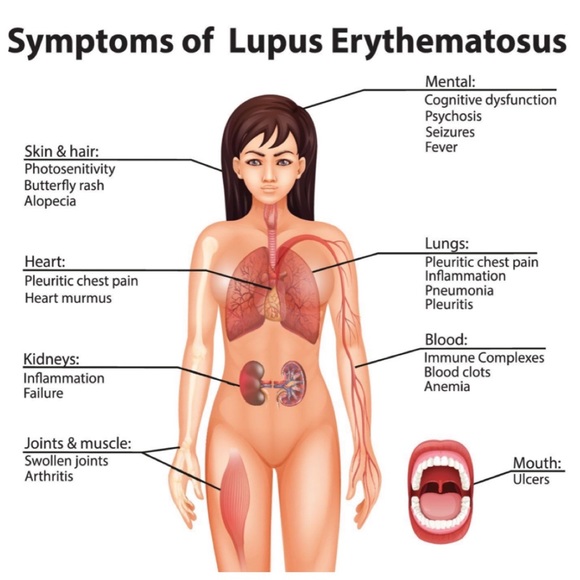 LUPUS AWARENESS PIN - Picture 3 of 5